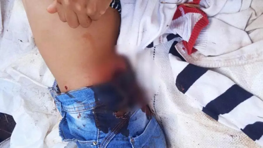 Brasilien: „Dringend: Schocktruppe schlachtet Guarani Kaiowá Jugendliche in Amambai, MS“