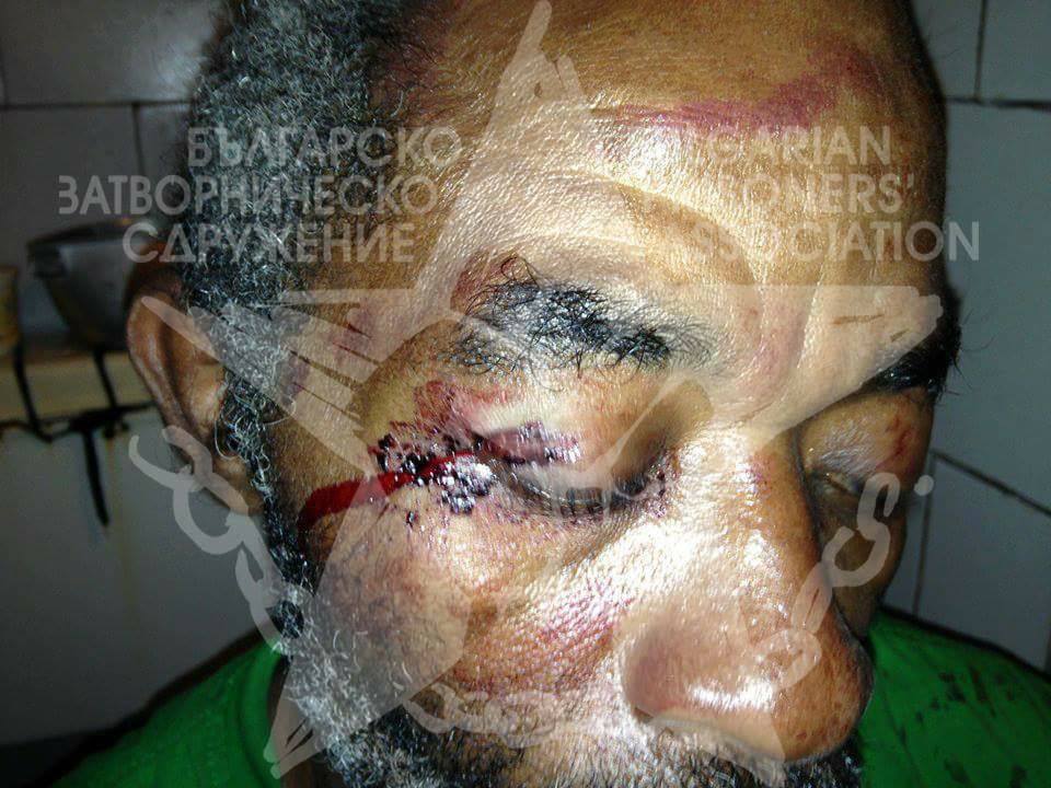 Bulgarien: Gefangene mobilisieren gegen Folter im Gefängnis