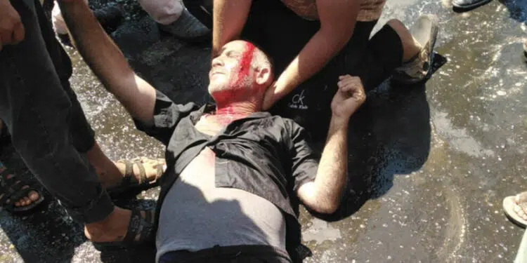 Verletzter bei Protesten gegen Stromausfälle Urfa 2021